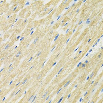 SLC19A1 Antibody - Immunohistochemistry of paraffin-embedded Rat heart using SLC19A1 Polyclonal Antibody at dilution of 1:100 (40x lens).