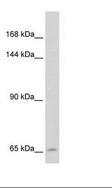 SLC19A1 Antibody - Jurkat Cell Lysate.  This image was taken for the unconjugated form of this product. Other forms have not been tested.