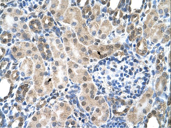 SLC19A1 Antibody - SLC19A1 antibody ARP44167_T100-NP_919231-SLC19A1(solute carrier family 19 (folate transporter), member 1) Antibody was used in IHC to stain formalin-fixed, paraffin-embedded human kidney.  This image was taken for the unconjugated form of this product. Other forms have not been tested.