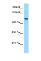 SLC19A2 / TC1 Antibody - SLC19A2 antibody Western blot of Fetal Heart lysate. Antibody concentration 1 ug/ml.  This image was taken for the unconjugated form of this product. Other forms have not been tested.