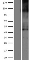 SLC19A2 / TC1 Protein - Western validation with an anti-DDK antibody * L: Control HEK293 lysate R: Over-expression lysate
