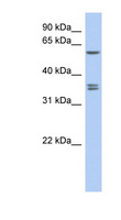SLC19A3 Antibody - SLC19A3 antibody Western blot of DU145 cell lysate. This image was taken for the unconjugated form of this product. Other forms have not been tested.