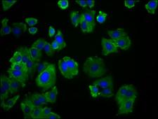 SLC19A3 Antibody - Immunofluorescence staining of HepG2 cells diluted at 1:166, counter-stained with DAPI. The cells were fixed in 4% formaldehyde, permeabilized using 0.2% Triton X-100 and blocked in 10% normal Goat Serum. The cells were then incubated with the antibody overnight at 4°C.The Secondary antibody was Alexa Fluor 488-congugated AffiniPure Goat Anti-Rabbit IgG (H+L).