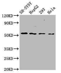 SLC19A3 Antibody - Western Blot Positive WB detected in: SH-SY5Y whole cell lysate, HepG2 whole cell lysate, 293 whole cell lysate, Hela whole cell lysate All Lanes: SLC19A3 antibody at 3.6µg/ml Secondary Goat polyclonal to rabbit IgG at 1/50000 dilution Predicted band size: 56 KDa Observed band size: 56 KDa