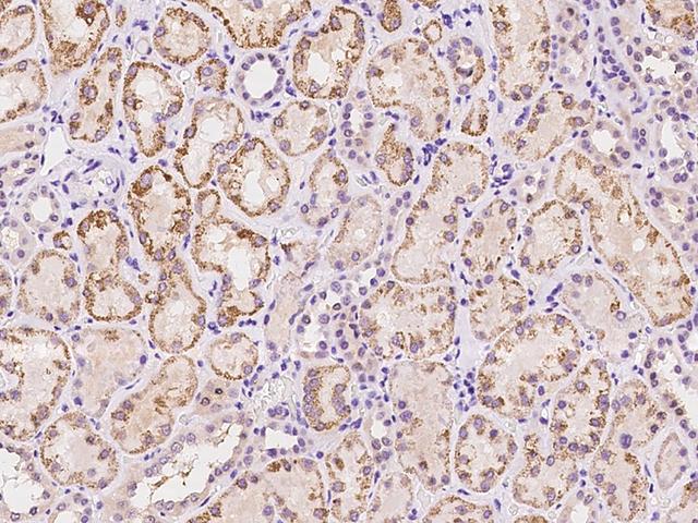 SLC19A3 Antibody - Immunochemical staining of human SLC19A3 in human kidney with rabbit polyclonal antibody at 1:300 dilution, formalin-fixed paraffin embedded sections.