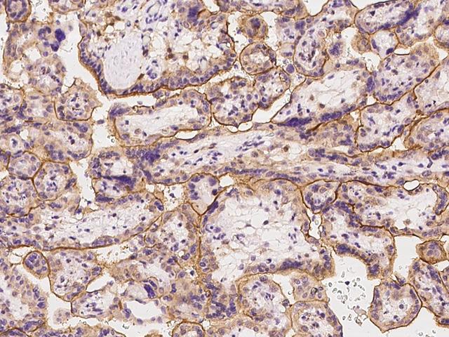 SLC19A3 Antibody - Immunochemical staining of human SLC19A3 in human placenta with rabbit polyclonal antibody at 1:300 dilution, formalin-fixed paraffin embedded sections.