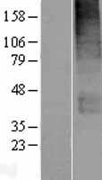 SLC19A3 Protein - Western validation with an anti-DDK antibody * L: Control HEK293 lysate R: Over-expression lysate