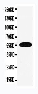 SLC1A1 / EAAT3 Antibody - EAAT3 antibody Western blot. WB: Human Placenta Tissue Lysate.