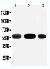 SLC1A1 / EAAT3 Antibody - EAAT3 antibody Western blot. Lane 1: Rat Liver Tissue Lysate. Lane 2: Rat Heart Tissue Lysate. Lane 3: HEPA Cell Lysate.