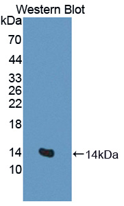 SLC1A1 / EAAT3 Antibody - Western blot of SLC1A1 / EAAT3 antibody.
