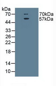 SLC1A1 / EAAT3 Antibody - Western Blot; Sample: Rat Brain Tissue.