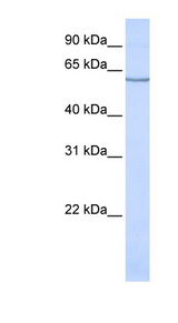 SLC1A1 / EAAT3 Antibody - SLC1A1 antibody Western blot of 721_B cell lysate. This image was taken for the unconjugated form of this product. Other forms have not been tested.