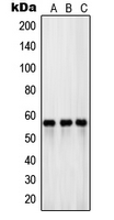 SLC1A1 / EAAT3 Antibody - Western blot analysis of EAAT3 expression in PANC1 (A); HeLa (B); human testis (C) whole cell lysates.