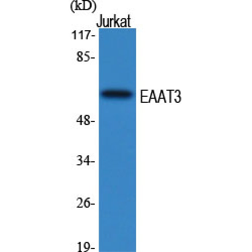 SLC1A1 / EAAT3 Antibody - Western blot of EAAT3 antibody