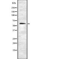SLC1A1 / EAAT3 Antibody - Western blot analysis SLC1A1 using NIH-3T3 whole cells lysates