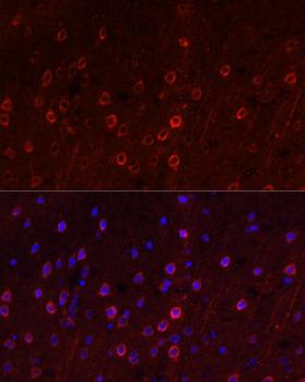 SLC1A1 / EAAT3 Antibody - Immunofluorescence analysis of Rat brain using SLC1A1 Polyclonal Antibody at dilution of 1:100.Blue: DAPI for nuclear staining.
