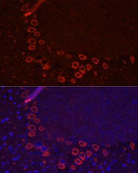 SLC1A1 / EAAT3 Antibody - Immunofluorescence analysis of Mouse brain using SLC1A1 Polyclonal Antibody at dilution of 1:100.Blue: DAPI for nuclear staining.