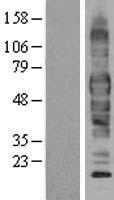 SLC1A1 / EAAT3 Protein - Western validation with an anti-DDK antibody * L: Control HEK293 lysate R: Over-expression lysate