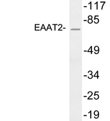 SLC1A2 / EAAT2 / GLT-1 Antibody - Western blot analysis of lysates from HeLa cells , using EAAT2 antibody.