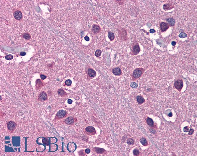 SLC1A2 / EAAT2 / GLT-1 Antibody - Anti-SLC1A2 / EAAT2 antibody IHC of human brain, cortex. Immunohistochemistry of formalin-fixed, paraffin-embedded tissue after heat-induced antigen retrieval. Antibody concentration 5 ug/ml.  This image was taken for the unconjugated form of this product. Other forms have not been tested.