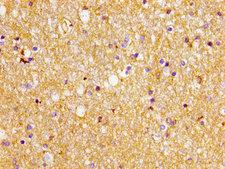 SLC1A2 / EAAT2 / GLT-1 Antibody - Immunohistochemistry image of paraffin-embedded human brain tissue at a dilution of 1:100