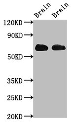 SLC1A2 / EAAT2 / GLT-1 Antibody - Positive Western Blot detected in Rat brain tissue, Mouse brain tissue. All lanes: SLC1A2 antibody at 3.2 µg/ml Secondary Goat polyclonal to rabbit IgG at 1/50000 dilution. Predicted band size: 63, 62 KDa. Observed band size: 63 KDa