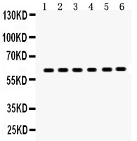 SLC1A2 / EAAT2 / GLT-1 Antibody - EAAT2 antibody Western blot. All lanes: Anti EAAT2 at 0.5 ug/ml. Lane 1: Rat Brain Tissue Lysate at 50 ug. Lane 2: Mouse Brain Tissue Lysate at 50 ug. Lane 3: U87 Whole Cell Lysate at 40 ug. Lane 4: SMMC Whole Cell Lysate at 40 ug. Lane 5: PANC Whole Cell Lysate at 40 ug. Lane 6: A549 Whole Cell Lysate at 40 ug. Predicted band size: 62 kD. Observed band size: 62 kD.