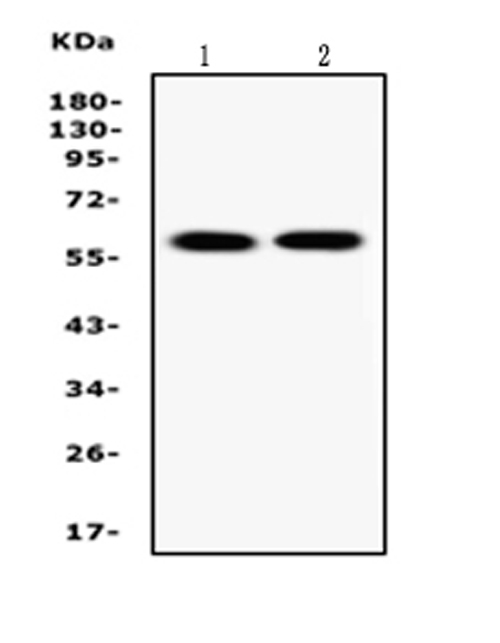SLC1A2 / EAAT2 / GLT-1 Antibody - Western blot analysis of EAAT2 using anti-EAAT2 antibody. Electrophoresis was performed on a 5-20% SDS-PAGE gel at 70V (Stacking gel) / 90V (Resolving gel) for 2-3 hours. The sample well of each lane was loaded with 50ug of sample under reducing conditions. Lane 1: rat brain tissue lysates, Lane 2: mouse brain tissue lysates. After Electrophoresis, proteins were transferred to a Nitrocellulose membrane at 150mA for 50-90 minutes. Blocked the membrane with 5% Non-fat Milk/ TBS for 1.5 hour at RT. The membrane was incubated with rabbit anti-EAAT2 antigen affinity purified polyclonal antibody at 0.5 µg/mL overnight at 4°C, then washed with TBS-0.1% Tween 3 times with 5 minutes each and probed with a goat anti-rabbit IgG-HRP secondary antibody at a dilution of 1:10000 for 1.5 hour at RT. The signal is developed using an Enhanced Chemiluminescent detection (ECL) kit with Tanon 5200 system. A specific band was detected for EAAT2 at approximately 62KD. The expected band size for EAAT2 is at 62KD.