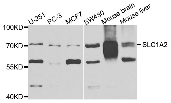 SLC1A2 / EAAT2 / GLT-1 Antibody - Western blot analysis of extracts of various cells.