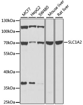 SLC1A2 / EAAT2 / GLT-1 Antibody - Western blot analysis of extracts of various cell lines, using SLC1A2 antibody at 1:1000 dilution. The secondary antibody used was an HRP Goat Anti-Rabbit IgG (H+L) at 1:10000 dilution. Lysates were loaded 25ug per lane and 3% nonfat dry milk in TBST was used for blocking. An ECL Kit was used for detection and the exposure time was 15s.