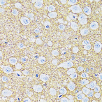 SLC1A2 / EAAT2 / GLT-1 Antibody - Immunohistochemistry of paraffin-embedded rat brain using SLC1A2 antibodyat dilution of 1:100 (40x lens).