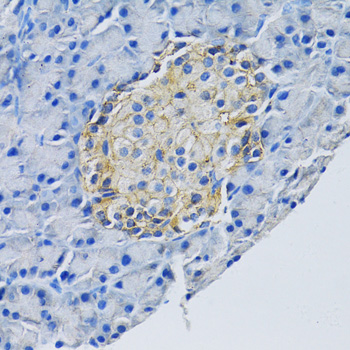 SLC1A2 / EAAT2 / GLT-1 Antibody - Immunohistochemistry of paraffin-embedded rat pancreas using SLC1A2 antibodyat dilution of 1:100 (40x lens).