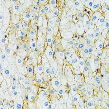 SLC1A2 / EAAT2 / GLT-1 Antibody - Immunohistochemistry of paraffin-embedded human liver using SLC1A2 antibodyat dilution of 1:100 (40x lens).
