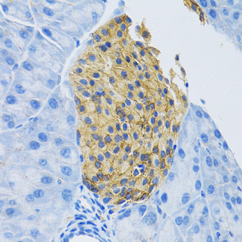 SLC1A2 / EAAT2 / GLT-1 Antibody - Immunohistochemistry of paraffin-embedded mouse pancreas using SLC1A2 antibodyat dilution of 1:100 (40x lens).