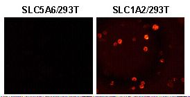 SLC1A2 / EAAT2 / GLT-1 Antibody - Transiently transfected HEK293T cells fixed in 4% PFA.