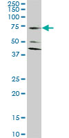SLC1A2 / EAAT2 / GLT-1 Antibody - SLC1A2 monoclonal antibody (M07), clone 1D8. Western blot of SLC1A2 expression in HeLa.