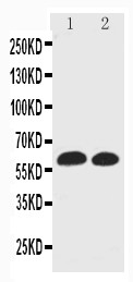 SLC1A3 / EAAT1 Antibody - WB of SLC1A3 / GluT-1 / GLAST antibody. Lane 1: Rat Brain Tissue Lysate. Lane 2: Mouse Brain Tissue Lysate.
