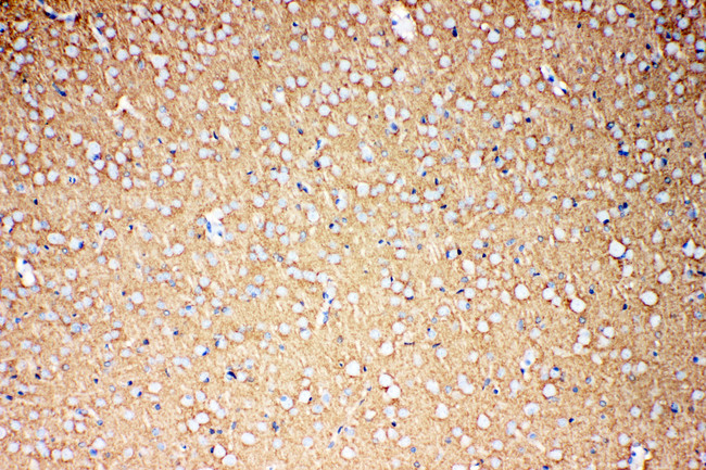 SLC1A3 / EAAT1 Antibody - SLC1A3 / GluT-1 / GLAST antibody. IHC(P): Rat Brain Tissue.