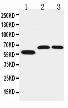 SLC1A4 / ASCT1 Antibody - WB of SLC1A4 / ASCT1 antibody. Lane 1: U87 Cell Lysate. Lane 2: Rat Brain Tissue Lysate. Lane 3: Mouse Brain Tissue Lysate.