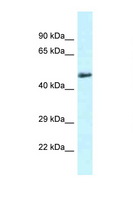 SLC1A4 / ASCT1 Antibody - SLC1A4 antibody Western blot of Mouse Heart lysate. Antibody concentration 1 ug/ml.  This image was taken for the unconjugated form of this product. Other forms have not been tested.