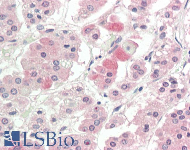SLC1A4 / ASCT1 Antibody - Human, Adrenal: Formalin-Fixed Paraffin-Embedded (FFPE).  This image was taken for the unconjugated form of this product. Other forms have not been tested.