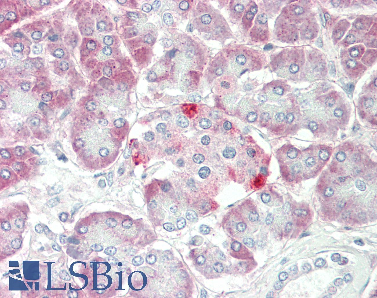 Anti-SLC1A4 / ASCT1 Antibody | Rabbit anti-Human Polyclonal IHC,WB | LSBio