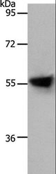 SLC1A4 / ASCT1 Antibody - Western blot analysis of Human liver cancer tissue, using SLC1A4 Polyclonal Antibody at dilution of 1:800.