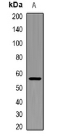 SLC1A4 / ASCT1 Antibody - Western blot analysis of ASCT1 expression in HepG2 (A) whole cell lysates.