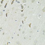 SLC1A4 / ASCT1 Antibody - Immunohistochemistry of paraffin-embedded rat brain using SLC1A4 antibody at dilution of 1:100 (40x lens).