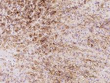 SLC1A4 / ASCT1 Antibody - Immunochemical staining of human SLC1A4 in human adrenal gland with rabbit polyclonal antibody at 1:500 dilution, formalin-fixed paraffin embedded sections.