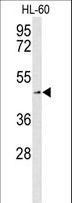SLC1A5 / ASCT2 Antibody - Western blot of SLC1A5 Antibody in K562 cell line lysates (35 ug/lane). SLC1A5 (arrow) was detected using the purified antibody.