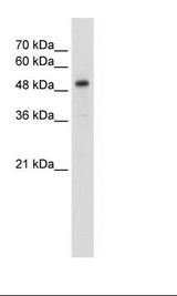SLC1A5 / ASCT2 Antibody - Jurkat Cell Lysate.  This image was taken for the unconjugated form of this product. Other forms have not been tested.