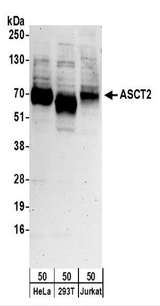 SLC1A5 / ASCT2 Antibody - Detection of Human ASCT2 by Western Blot. Samples: Whole cell lysate (50 ug) from HeLa, 293T, and Jurkat cells. Antibodies: Affinity purified rabbit anti-ASCT2 antibody used for WB at 0.1 ug/ml. Detection: Chemiluminescence with an exposure time of 3 minutes.