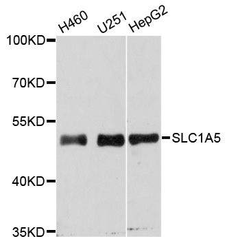 SLC1A5 / ASCT2 Antibody - Western blot analysis of extracts of various cell lines.
